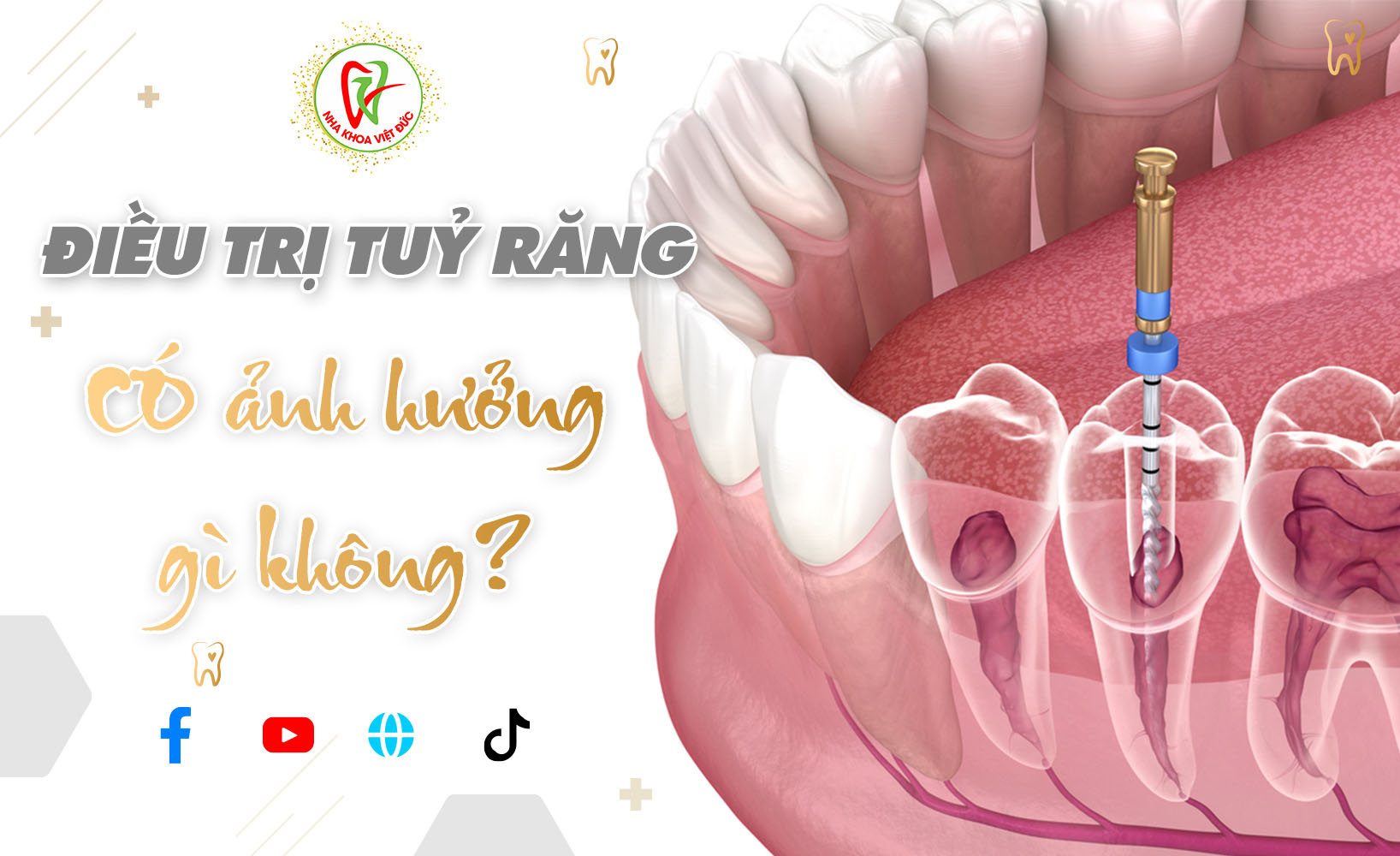 ĐIỀU TRỊ TỦY RĂNG CÓ ẢNH HƯỞNG GÌ KHÔNG?