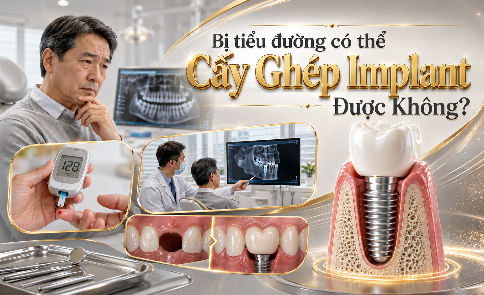 Tiểu đường có cấy Implant được không? Những yếu tố cần đánh giá